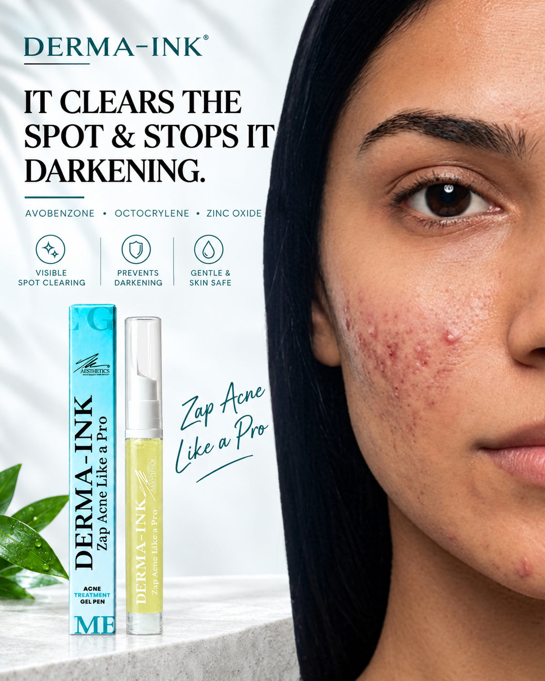 Derma-Ink acne treatment gel pen - it clears the spot and stops it darkening