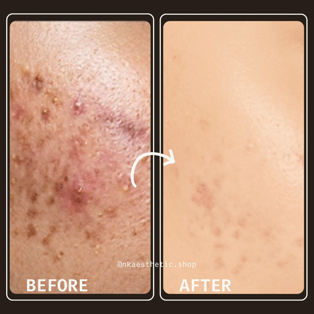 NK Aesthetics Derma-ink Customer Reviews