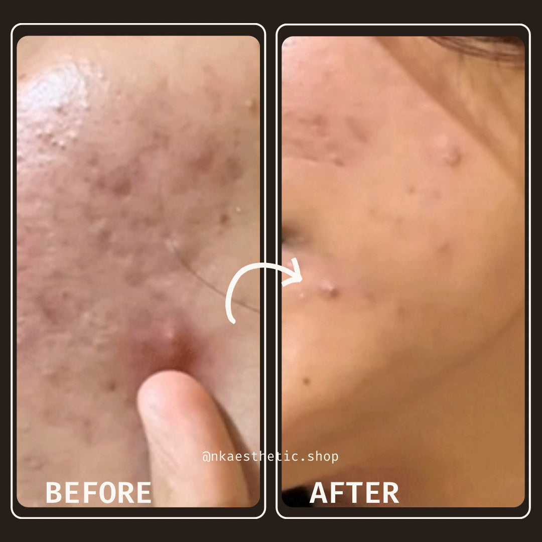 NK Aesthetics Derma-Ink Customer Reviews